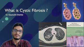 What is Cystic Fibrosis   Pathogenesis at cellular level Dr Kaustubh Mohite [upl. by Rumpf864]