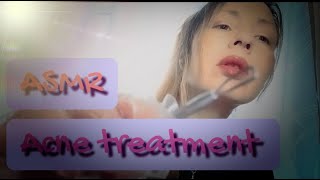 ASMR  Acne treatment  Dark spots removing 👩🏼✨😇 [upl. by Anissa]