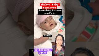 Bacche ko zor zor se hilana  permanent damage  jaanleva  Shaken baby syndrome 😟shorts baby [upl. by Aninnaig310]