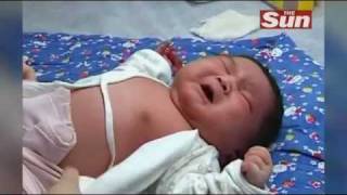 Massive baby weighing 15 pounds born in China [upl. by Koziara]