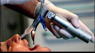 Endotracheal Tube ETT Intubation [upl. by Sadler712]