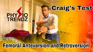 What Is Femoral Anteversion amp Retroversion and How To Test Physio trendz Physical therapy [upl. by Girand]