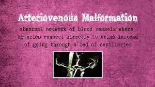 Arteriovenous Malformation [upl. by Aicekal]