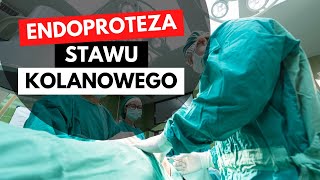 WYMIANA STAWU KOLANOWEGO ENDOPROTEZA  Co robić  TOP 3 PORADY [upl. by Maighdiln]