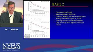 Paclitaxel Drug Coated Technology vs Sirolimus Coated Technology for Infra Popliteal Disease Lawrenc [upl. by Aivax]