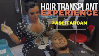 FUE Hair Transplant Experience Asli Tarcan BlackSpanish Hair Type [upl. by Slade810]