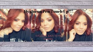 Hyaluron PenHylaronic Acid Touch up 2nd Time [upl. by Ariem529]