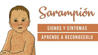 Sarampión explicación con dibujos  cómo reconocer el Sarampión  Cómo se transmite el Sarampión [upl. by Annahsirhc308]