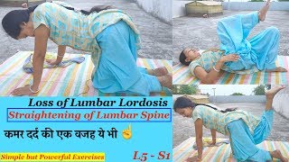 Straightening of Lumbar Lordosis  कमरदर्द  Lumbar Spine Straightening [upl. by Irovi]