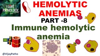 Hemolytic Anemias Part 8 Immune Hemolytic Anemia IHA [upl. by Euqinorev249]