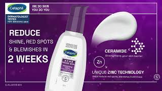 Acne Woes Hydrate and strengthen  try Cetaphil [upl. by Aniri]