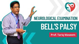 Bells Palsy  Neurological Examination by ProfTariqWaseem medical education medicalexamination [upl. by Katlaps]