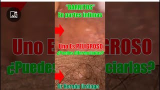 “BARRITOS” en partes íntimas  ¿cuáles son PELIGROSOS barrito espinilla acne molusco its ets [upl. by Wil257]