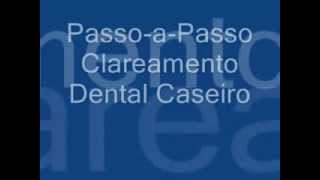 Clareamento dental com moldeira [upl. by Husain734]