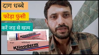 दाग धब्बे फोड़े फुंसियों के लिए आयुर्वेदिक इलाज klinoderm cream review [upl. by Daney538]