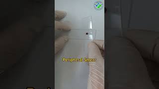 Making a peripheral blood smear  blood smear preparation  prepare a perfect blood smearHematology [upl. by Leiru]