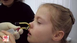 YAMIK procedure  a method for topical treatment of sinusitis [upl. by Antrim973]