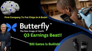 Butterfly Network Bullish Earnings First Company To Ever Implant Chips In Brains Gates Is Bullish [upl. by Kovar987]