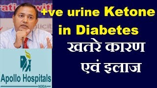 HbA1C Test kya hota hai  What is a normal HbA1c level  HbA1C test Report  Test For Diabeties [upl. by Sone]