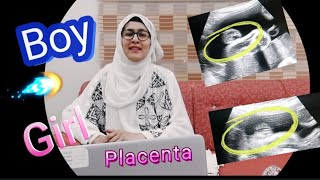 Fundal Height Measurement by Weeks Nursing Maternity Lecture NCLEX [upl. by Kesley]