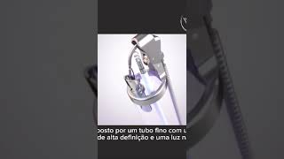 A gastroplastia endoscópica é um procedimento delicado que requer habilidade e precisão [upl. by Yrred]