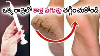 in Just 5 Minutes  Get Rid Of CRACKED HEELS Permanently Magical Cracked Heels Home Remedy [upl. by Lydnek748]