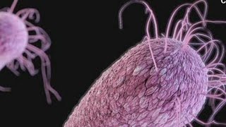 New study raising alarms about superbugs [upl. by Nolek]