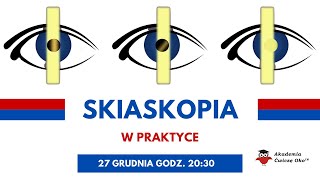 Skiaskopia w praktyce  Barbara Pakuła  Ćwiczę oko [upl. by Whipple]