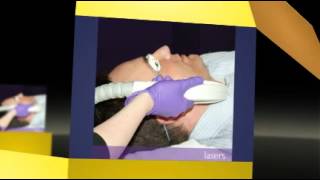 Syneron Laser Repair [upl. by Ennylhsa590]