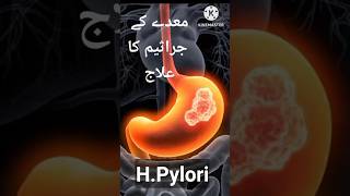 HPylori Helicobacter Pylori Signs Symptoms Lab Test and Treatment hpylori treatment shorts [upl. by Ing]