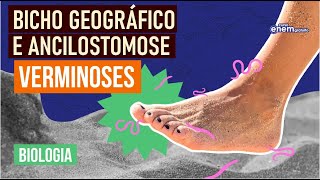 ANCILOSTOMOSE E BICHO GEOGRÁFICO tipos de verminoses  Resumo de Biologia Enem  Cláudia Aguiar [upl. by Enilkcaj220]