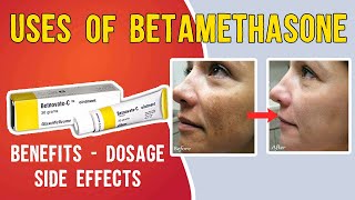 What is Uses of Betamethasone Betaderm Betnovate  betnovate c skin cream  Benefits Dosage [upl. by Grussing]