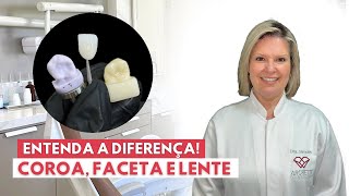 Entenda a Diferença Coroa Lente de contato e Faceta [upl. by Sankey]