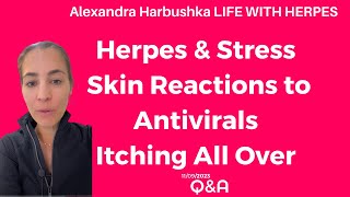 Herpes amp Stress Skin Reactions to Antivirals Itching All Over with Herpes 11092023 [upl. by Ekal647]