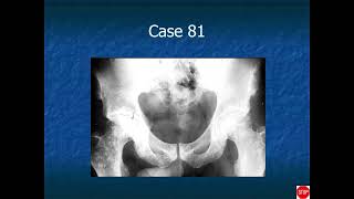 RADIOLOGY EXAM CASES [upl. by Glorianna]