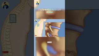 Triactin 4 Tablet Uses  Thiocolchicoside aceclofenac and paracetamol tablet uses [upl. by Ynneb]