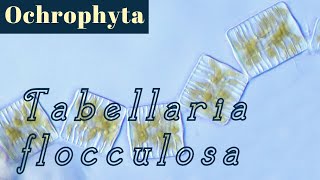 Tabellaria flocculosa Bacillariophyceae or Diatoms [upl. by Llerahs]