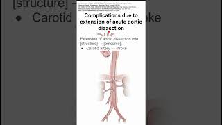 Complications due to extension of acute aortic dissection [upl. by Cott]