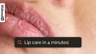 How To Get Rid Of Chapped Lips  Lip Care 101  From Exfoliating To Moisturizing ✨ [upl. by Aleck422]