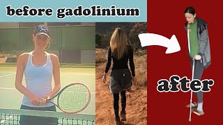 Gadolinium Side Effects or Permanent Disability  Marie Noëls Gadolinium Toxicity MRI Story [upl. by Grof]