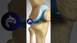 See how an ACL is reconstructed using a Hamstring Tendon Graft  3D Animation knee kneeinjury [upl. by Guimond]