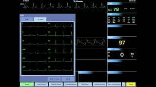 REALITi 18 12 lead ECGs [upl. by Cirillo]