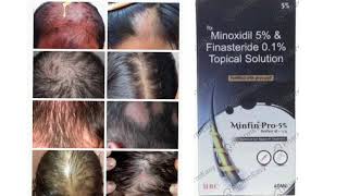 Minfin Pro 5 Topical Solution Minoxidil 5 amp Finasteride 01 Topical Solution [upl. by Cthrine]