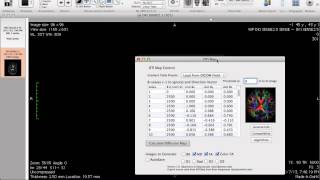 DTIMap Osirix Plugin Demo [upl. by Asirak]