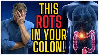 7 Things Rotting in Your Colon Right Now What Rots in Your Colon 2024 [upl. by Tony]