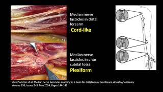 Neuromusculoskeletal Ultrasound for Peripheral Nerve Entrapment and Nerve Injuries [upl. by Sitoel799]