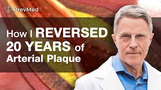 How I Reversed 20 years of Arterial Plaque [upl. by Inar874]