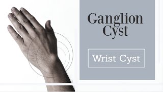 Wrist Ganglion Cyst [upl. by Gayner]