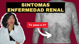 los PEORES signos de INSUFICIENCIA RENAL que no conoces ✋🏻🛑 [upl. by Tica]