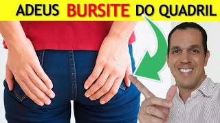 BURSITE NO QUADRIL  VEJA ESSE TRATAMENTO NATURAL [upl. by Omrelliug]